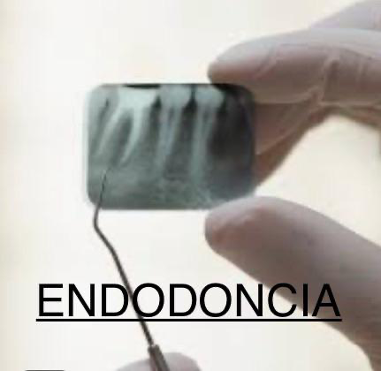 Servicio de endodoncia